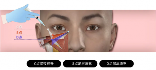 丽扬.png